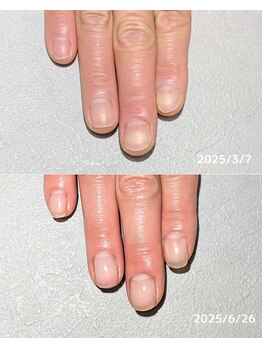 サロンペペ(salon pepe)の写真/諦めかけていたネイルも自爪育成の『salon pepe』で自信の持てる指先へ♪