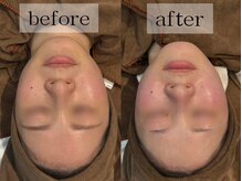 グランビューティ(Glanz Beauty)/20代女性