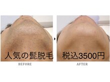 サロンリノア(salon linoa)/