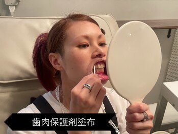 リオッサ オブ ラグーン(RIOSSA of Lagoon)/歯肉保護剤塗布　無味無臭！