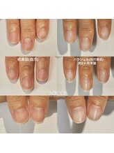 ニコプラス(NICO+)/自爪育成中