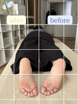 ルミナフローム(LuminaFlowm)/ビフォーアフターその2