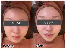 ミューズ よもぎ蒸し(MUSE)/◆インモード◆