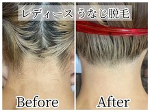 イデアルボーテ/うなじこそ美しく清潔に