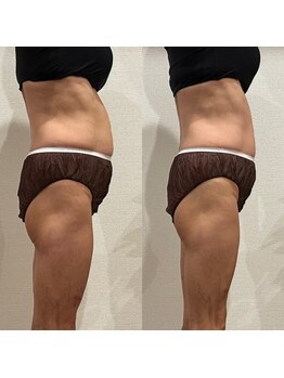 ミ ライト(m light)/