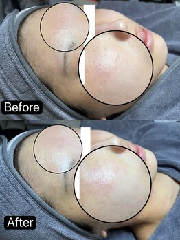 リル(Rire)/Before→After