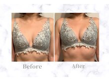 ふじこのきもち/初回の変化　40代授乳後