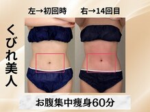 イヨヨ(iyoyo)/【痩身】Before After