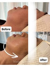 マウム(Maum)/二重あごすっきり・Vライン