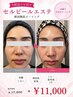 【韓国ツヤ肌】剥離なしセルピール体験！通常価格17000→11000