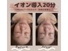 YUKO指名【疲れ顔リセット！カクテル美容原液を配合してイオン導入】 20分