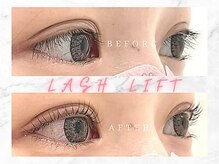 ラ ブレス 北浜プラザ(LaBless)/ご用意しているロッドは30種類!!