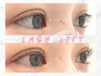 ラ ブレス 北浜プラザ(LaBless)/ご用意しているロッドは30種類!!