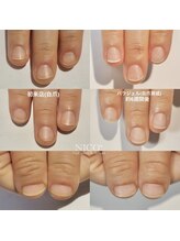 ニコプラス(NICO+)/自爪育成中