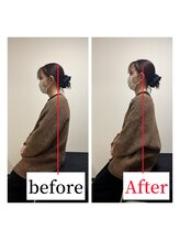 整体院ストック(Stock)/猫背・巻き肩before after #整体