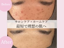 ミュー 豊田店(mieux)/◆サロンケア×ホームケアが最強