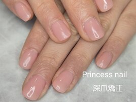 深爪矯正+ピンクジェルネイル