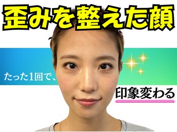 ナチュラルビューティーフェイス 横浜(NBF)/左右差・顎の歪み30代／横浜小顔