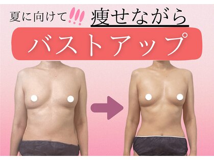 マリン(MARINE)の写真