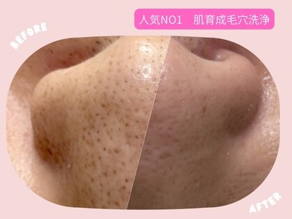 Wax脱毛&毛穴専門店　D-lotusの写真
