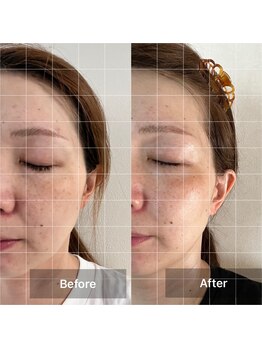 アットユウ(@yu)/フェムフェイシャル