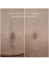 トゥルーリー(TRULY)/《ギャランドゥーのワックス》