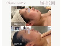 パルタージュ(Partage)/オーダーメイドエステ