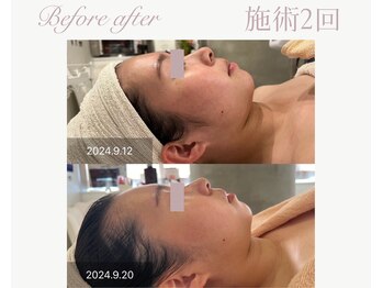 パルタージュ(Partage)/オーダーメイドエステ