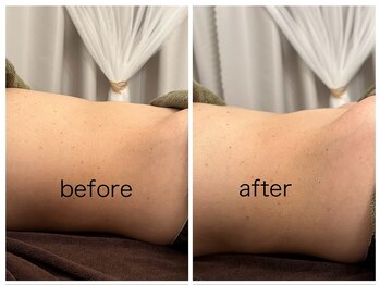 ムウ ヘブン(muu heaven)/before→after