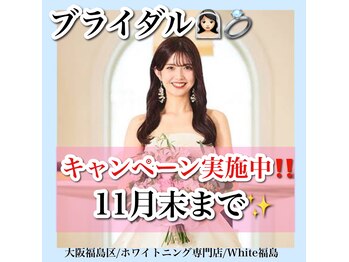 ホワイトニングサロン ホワイト(WHITE)/セルフホワイトニング/大阪/福島