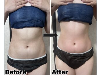 カピリナ(Kapilina)/ WINBACK2回 【20代後半女性】