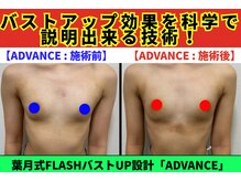 セブンシーズ 上野店(Seven Seas)/バストアップ/豊胸/東京都/上野