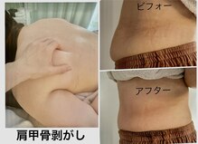 メディカルエステ ユウ(Yuu)