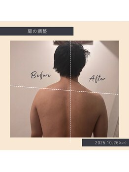 ソロウノ 平和島本院/肩凝り改善
