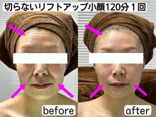 ユーフォリア(Euphoria)