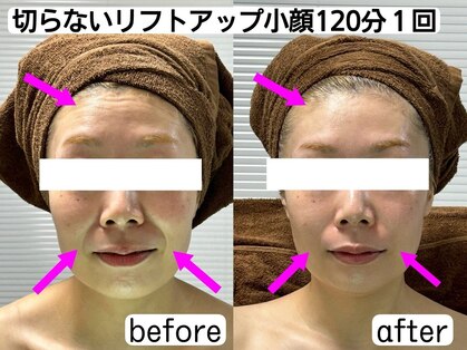 ユーフォリア(Euphoria)の写真