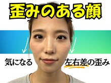 ナチュラルビューティーフェイス 横浜(NBF)/頬骨・左右差・20代／横浜駅小顔