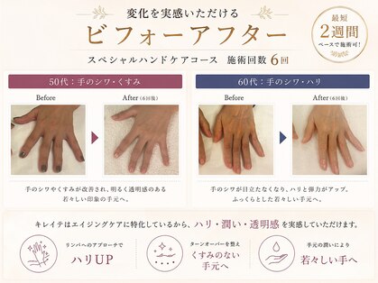 ハンドケアサロン キレイテ上野店 ＜手のシワ/乾燥/くすみ/血管の浮き/老け手＞の写真