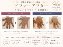キレイテ 上野店