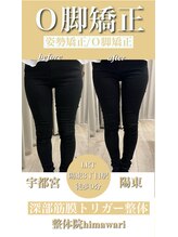 整体院 ヒマワリ(himawari)/整体ビフォーアフター