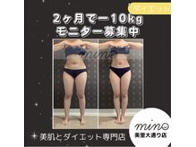 ミノ 美里大通り店(mino)/ダイエットパッケージ