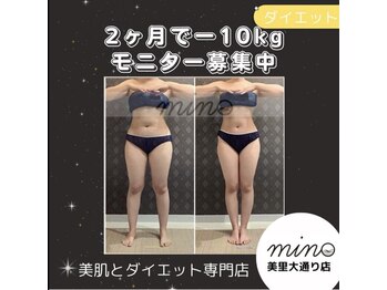 ミノ 美里大通り店(mino)/ダイエットパッケージ