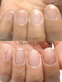 マリーロール 梅田店(Marie Laure)/深爪矯正/自爪育成/ネイルケア