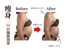 アライア(Alaia)の雰囲気（リンパケア、痩身マッサージ、筋膜リリースや筋肉にアプローチ♪）