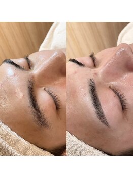 ネイルアンドビューティー バイ ウノ(Nail&Beauty by UNO)/メンズ眉WAX