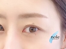 ノーレ 阿倍野 昭和町(nole)/立ち上げ×ストレート/パーマ♪