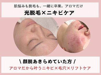 アロマ(AROMA)の写真