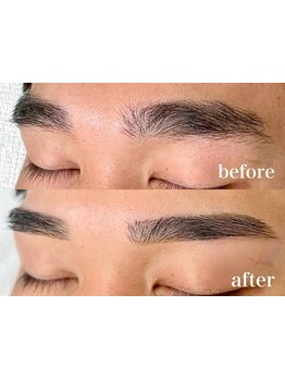 メンズフェイシャル