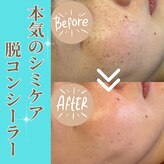 クリニカルホワイトケア 福岡店(クリニカルWHITEケア)