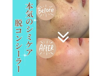 クリニカルホワイトケア 福岡店(クリニカルWHITEケア)